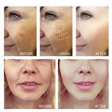 Load image into Gallery viewer, Retinol Shot Wrinkle Remover Cream